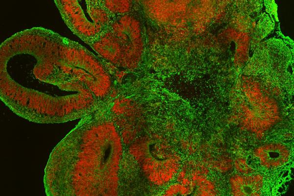 image002 crp