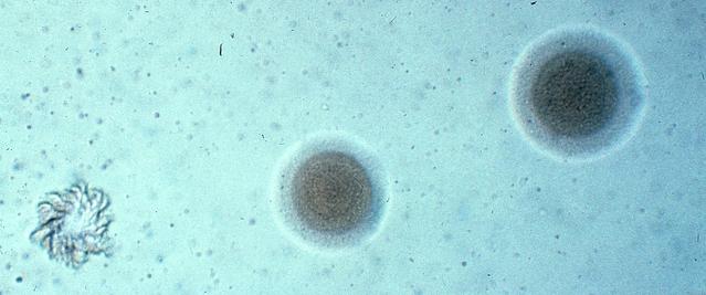 Pneumoniae20colony1