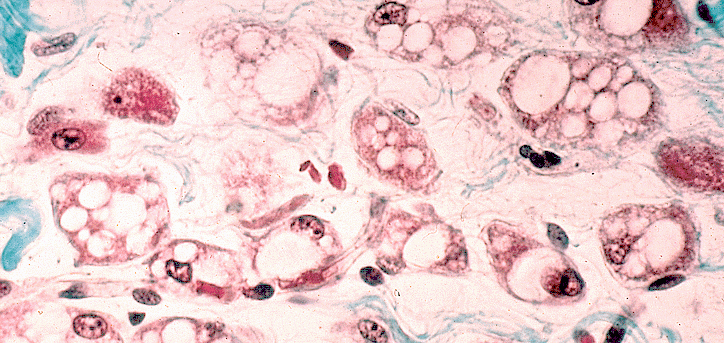 Brown20fat20cells1