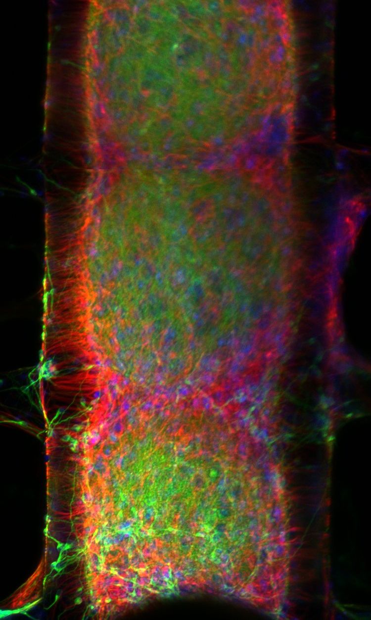 organoid image 0
